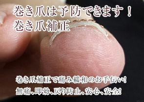 巻き爪ロボ補正